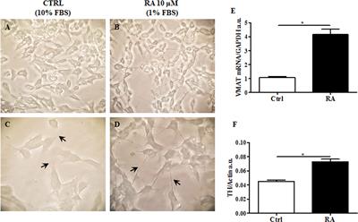 Insulin and Exendin-4 Reduced Mutated Huntingtin Accumulation in Neuronal Cells